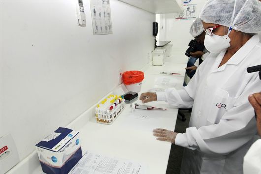 Bahia desenvolve primeiro teste rápido do Zika Vírus no Brasil 5